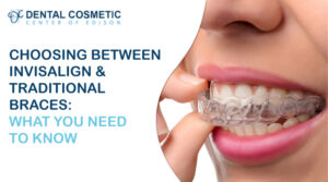 Choosing Between Invisalign and Traditional Braces: What You Need to Know