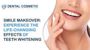 Oral Hygiene: The Neglected Health Domain